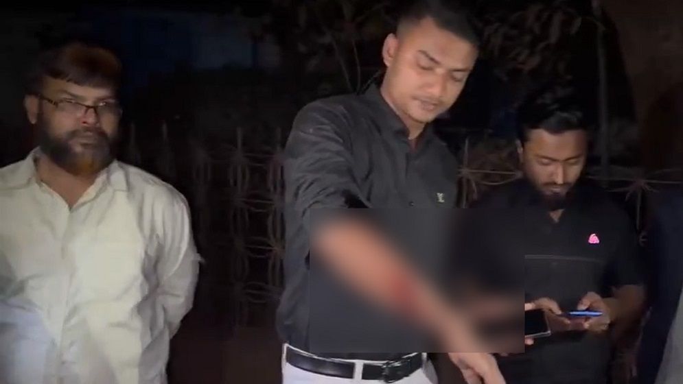 গাজীপুরে বৈষম্যবিরোধী আন্দোলনকারীকে গুলি করেছে দুর্বৃত্তরা