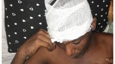 নাটোরে জামায়াত-বিএনপি সংঘর্ষ, আহত ১০