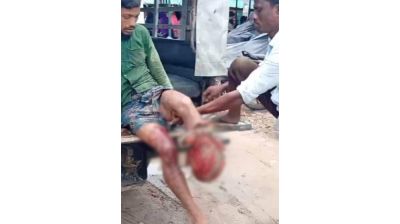 ঘুমধুম সীমান্তে মাইন বিস্ফোরণে বাংলাদেশি যুবকের পা বিচ্ছিন্ন