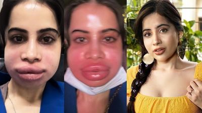 মুখ-ঠোঁট ফুলে ভাইরাল উরফি জাভেদ