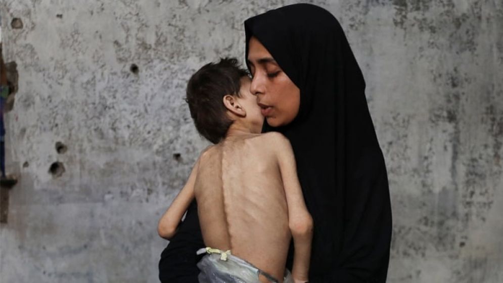 গাজায় এক মায়ের আকুতি : আমরা মারা যাচ্ছি, বাঁচান