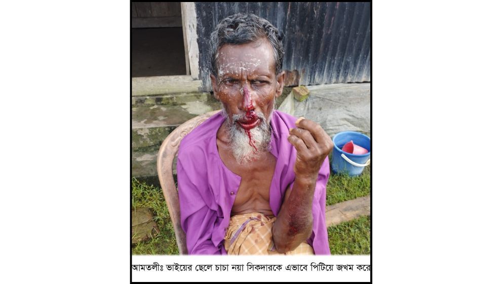 বেড়া ভাঙ্গার প্রতিবাদ করায় চাচাকে পিটিয়ে জখম