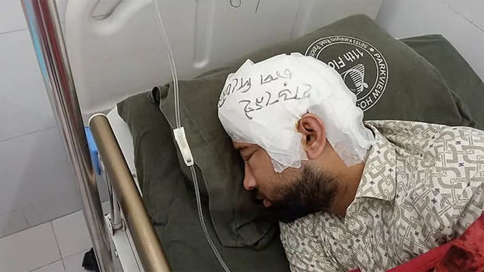 ‘হাড় নেই, চাপ দেবেন না’ চবি শিক্ষার্থীর মাথায় সতর্কবার্তা