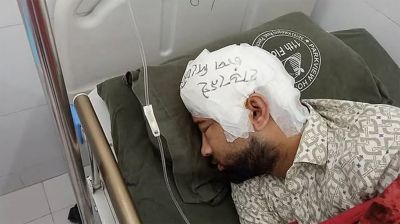 ‘হাড় নেই, চাপ দেবেন না’ চবি শিক্ষার্থীর মাথায় সতর্কবার্তা