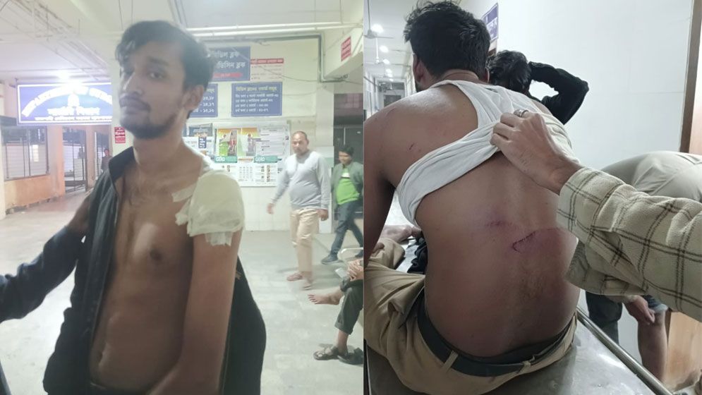 দুর্বৃত্তদের হামলায় আহত রাবির তিন শিক্ষার্থী