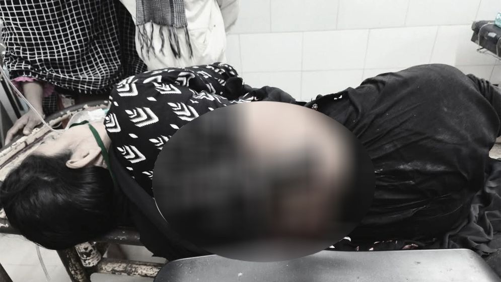 বগুড়ায় স্ত্রীকে ছুরিকাঘাত করে স্বামীর আত্মসমর্পণ