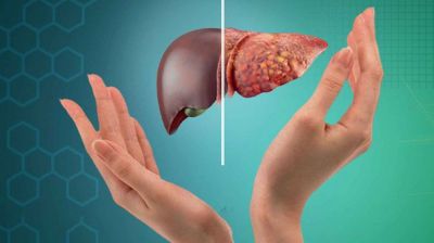 ফ্যাটি লিভারের ৮টি লক্ষণ যা দেখা মাত্র উপেক্ষা করা যাবে না