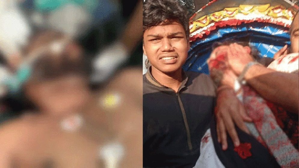 লাইফ সাপোর্টে ওসমান হাদি