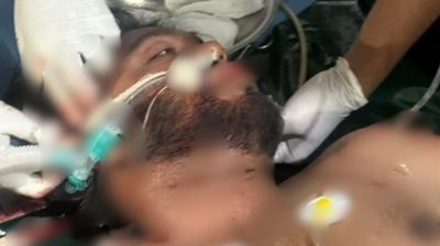 ওসমান হাদীর সর্বশেষ অবস্থা জানালেন চিকিৎসক