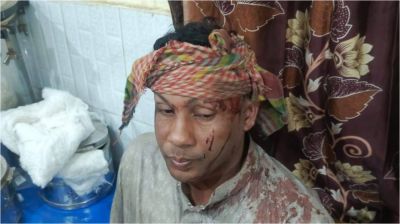 চৌদ্দগ্রামে জামায়াত-বিএনপির নেতাকর্মীদের সংঘর্ষ