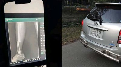 অধ্যাপকের গাড়ির ধাক্কায় পা ভাঙল রাবি ছাত্রীর