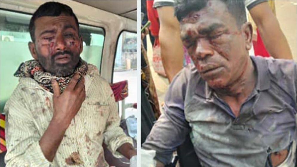 ককটেল বিস্ফোরণে দুই শ্রমিক আহত