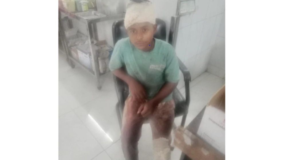 সোনারগাঁয়ে মাংস ব্যবসায়ীর ১০ লাখ টাকা ছিনতাই, ৩ জনকে কুপিয়ে ও পিটিয়ে জখম