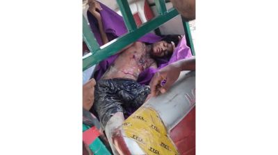 সীমান্তে মাইন বিস্ফোরণে এক রোহিঙ্গা যুবক আহত