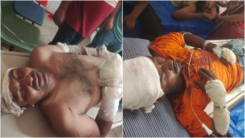 নারায়ণগঞ্জে র‍্যাবের অভিযানে হামলা, ৩ র‍্যাব সদস্যকে কুপিয়ে আহত