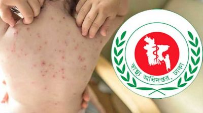 ২৪ ঘণ্টায় হাম ও উপসর্গে আরও ৭ শিশুর মৃত্যু