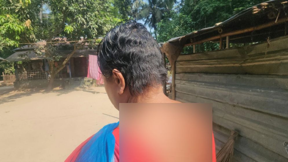 পরকীয়া সন্দেহে নারীর চুল কেটে শরীরে মরিচের গুঁড়া দিয়ে নির্যাতনের অভিযোগ