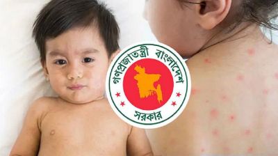 হাম উপসর্গে আরও ৪ জনের মৃত্যু